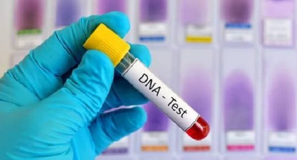 DNA Testing